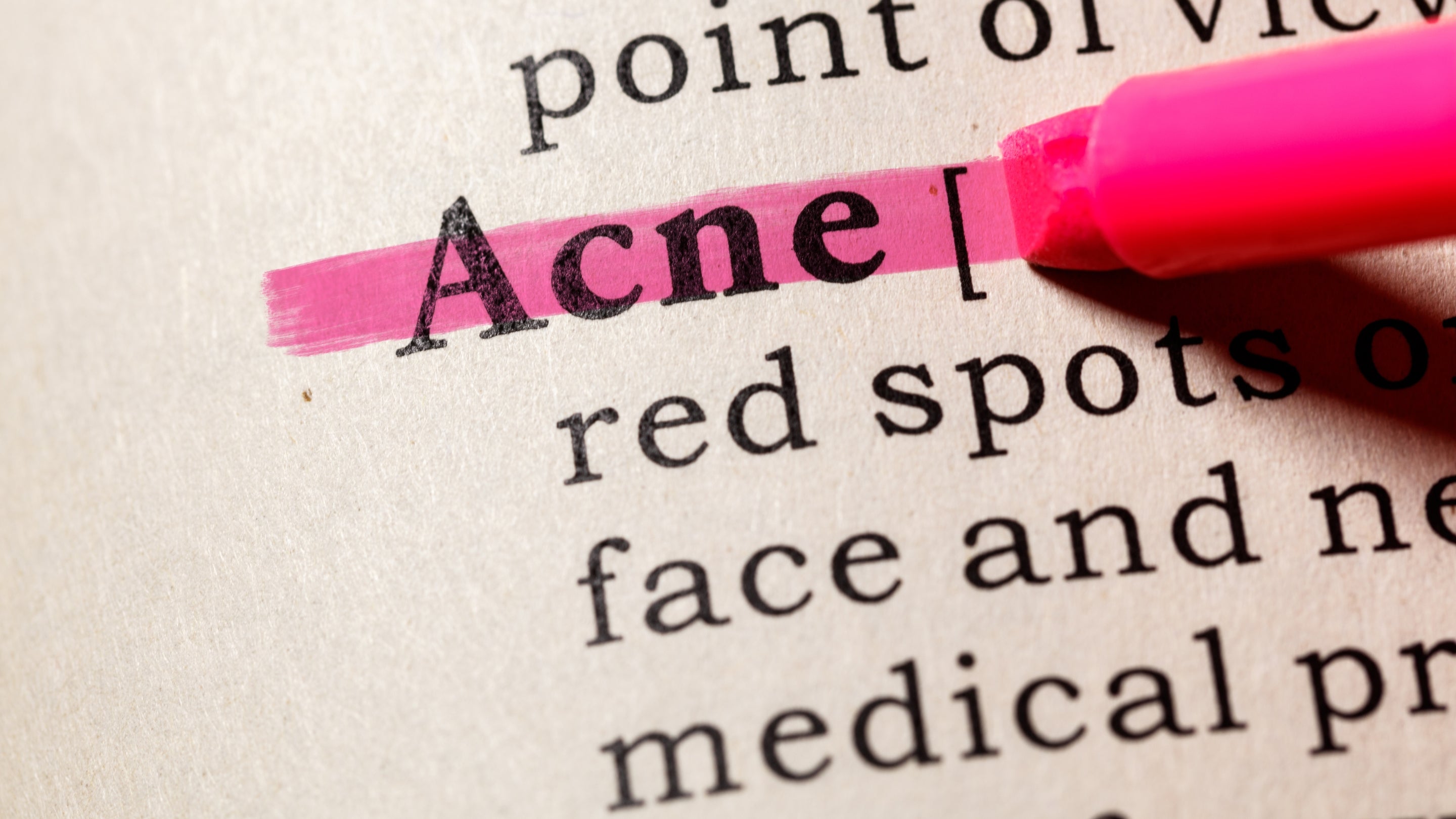 Can Cystic Acne Be Cured?